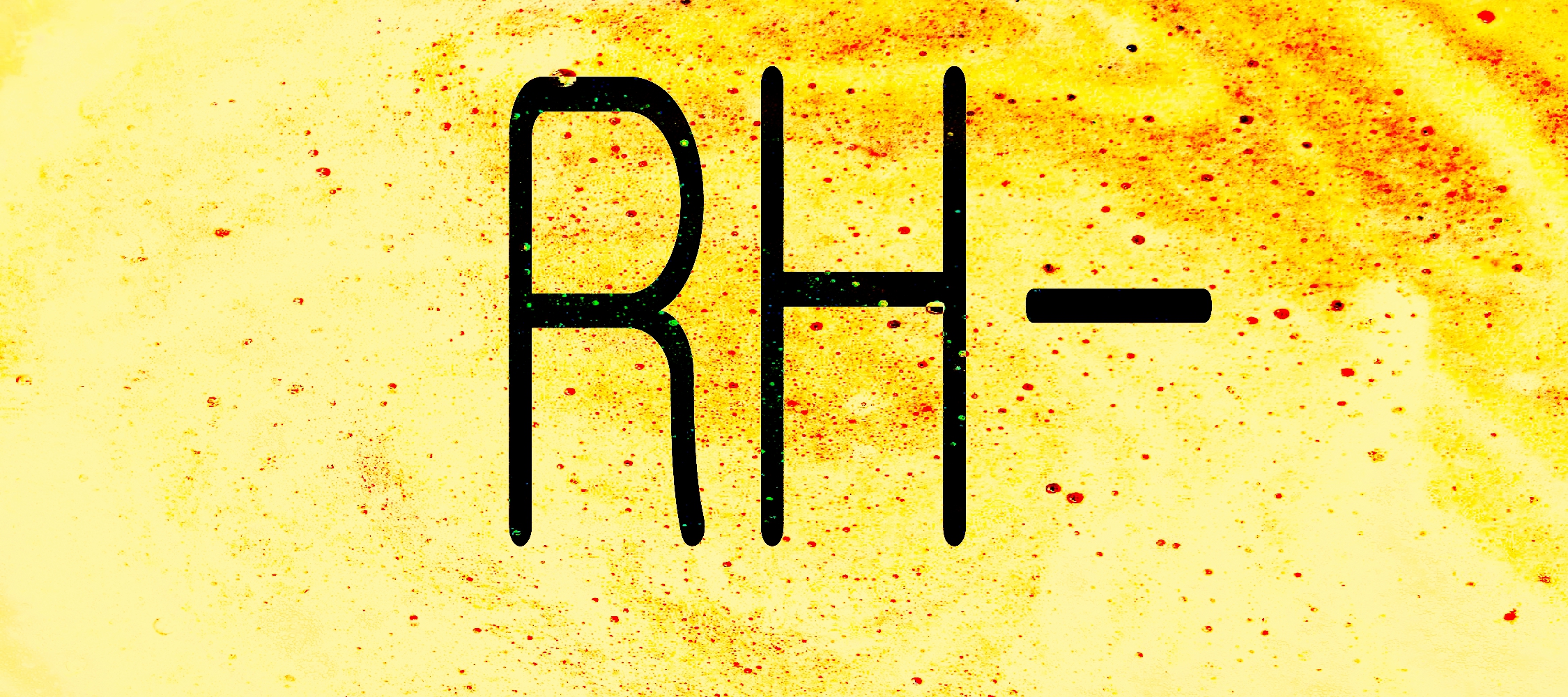 Speak Easy: I’m An Alien?