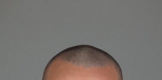 Jewelry Store Robber Arrested