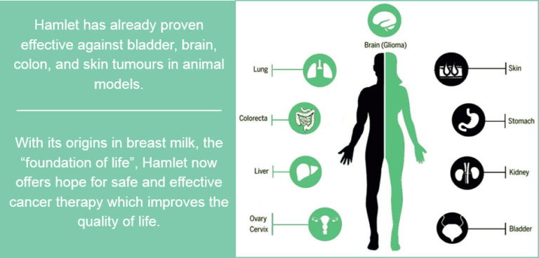 Breast Milk Substance Kills Cancer Cells