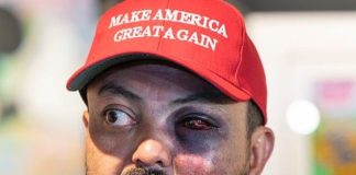 New Yorker In MAGA Hat Attacked