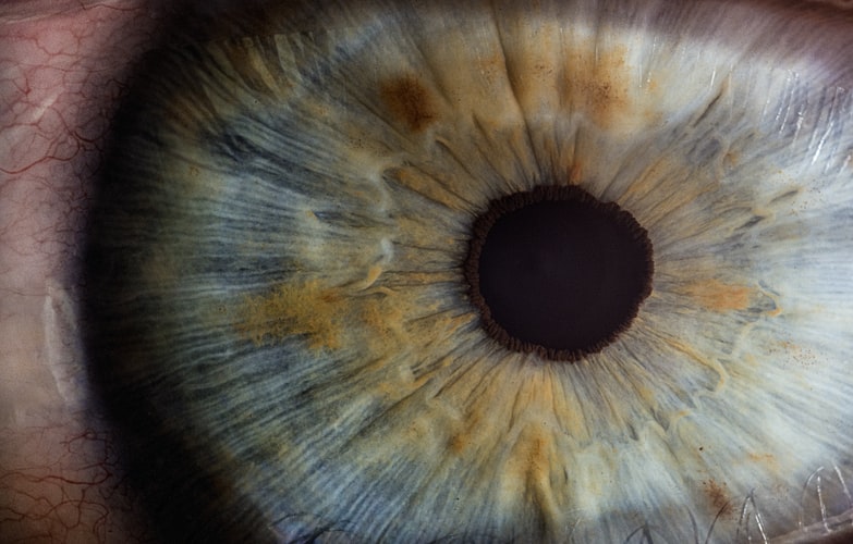Eye