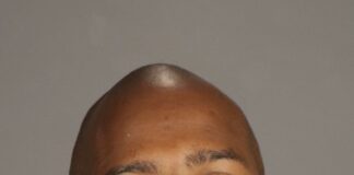 Two Suspects In Strong Arm Robbery Arrested