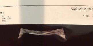 Dupont’s All Trimester Abortion Clinic BH Lease, Canceled