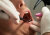 How Often A Deep Dental Cleaning Is Recommended And What Determines Frequency
