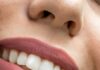 What To Know About The Right Age For Teeth Whitening Treatment