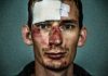 How Injury Victims Recover After A Serious Life-Altering Accident