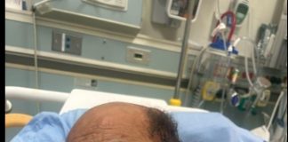 Retired Teacher Robbed And Beaten In Hollywood
