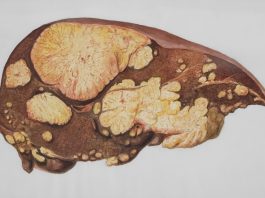Natural Ways To Support Your Liver Through Diet and Daily Habits