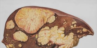 Natural Ways To Support Your Liver Through Diet and Daily Habits